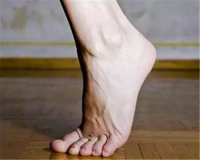 心脏不好,少碰“2黄”,多吃“2红”,远离4件事