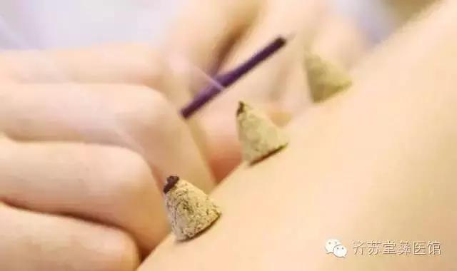 艾灸养生，更养女人