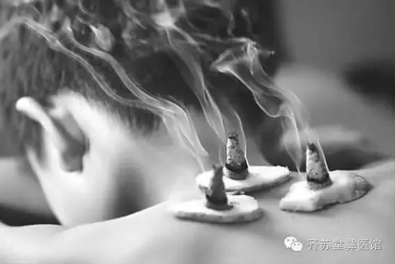艾灸养生，更养女人