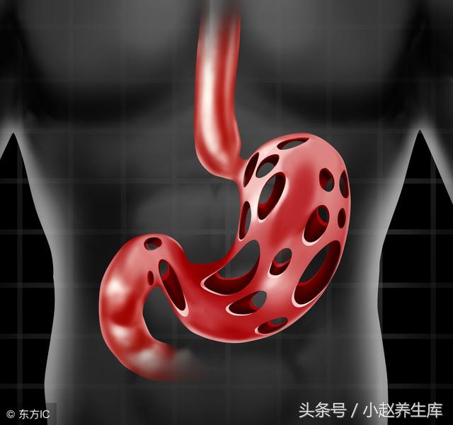 胃癌多半是“吃”出来的?医生说:胃不好的人,少碰这5种食物!