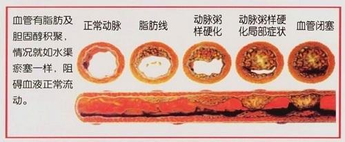 天气越来越冷：别嘴上喊着养生，身体却在轻生
