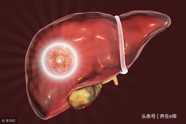 肝不好,身体1处变白、2处变黄、3处变黑,提醒你该去检查一下