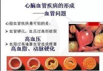 所有的心梗猝死,其实都“蓄谋已久”,别说你还年轻!
