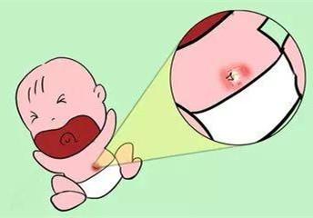 新生儿易患的10种常见疾病,如何预防,产妇早知道,宝宝少受罪!