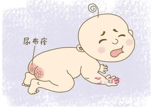 新生儿易患的10种常见疾病,如何预防,产妇早知道,宝宝少受罪!