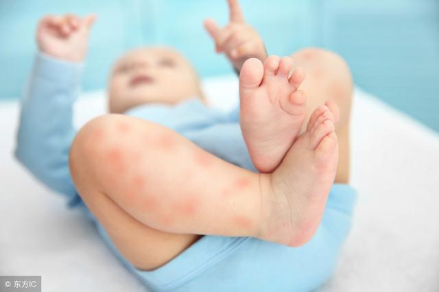 日常如何预防婴幼儿皮肤疾病？做好这2件小事，或能让你心满意足