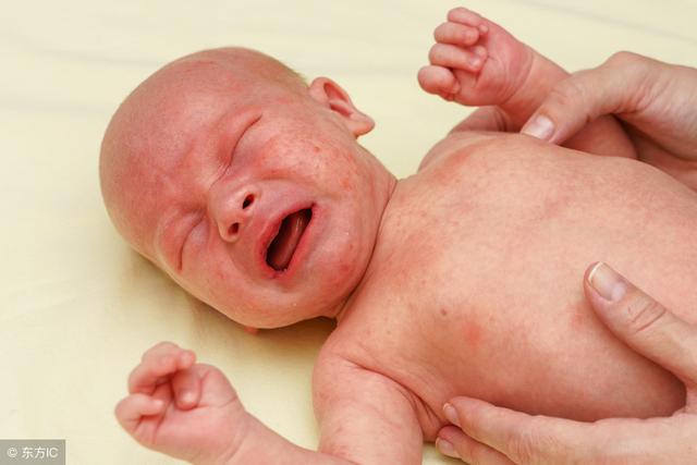日常如何预防婴幼儿皮肤疾病？做好这2件小事，或能让你心满意足