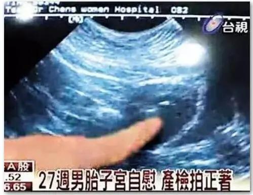 怀孕这22个冷知识,全知道的孕妈太少了
