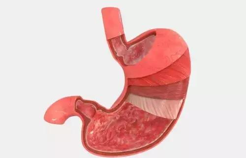 想要胃健康,保持4点好习惯,告别胃痛,预防胃炎
