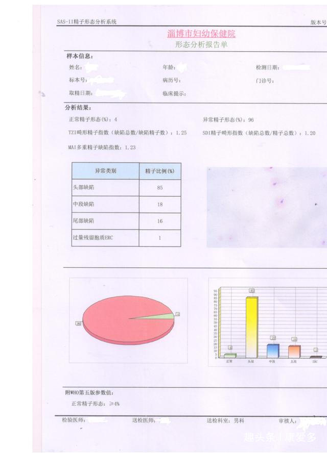 您了解精液检查么？花1分钟了解精液检验，明白精子的“色香味”