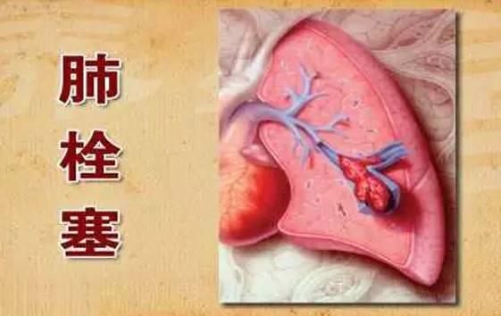 明日天气|多云,有雾、有微雪(附:99%的血栓无征兆!记住一个字,让你一生无栓!)