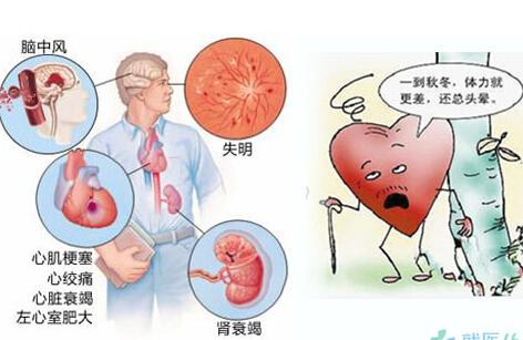 通过高血压防治学习疾病的“三级预防”