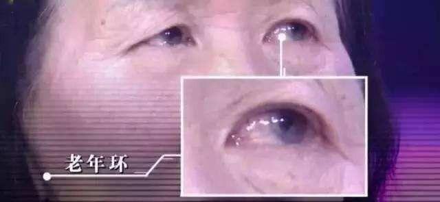 「收藏」各种疾病的早期信号，太全了