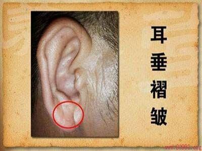 「收藏」各种疾病的早期信号，太全了