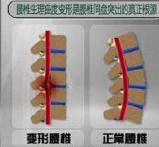 预防腰椎病注意这6个细节