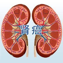 尿毒症如何预防?注意这几点