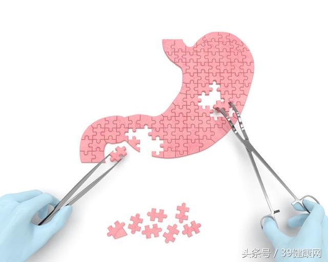 好胃全靠养！预防胃病有5招，不花一分药钱！