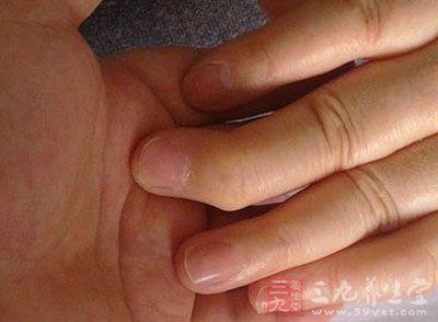 风湿病的原因 怎样预防风湿病
