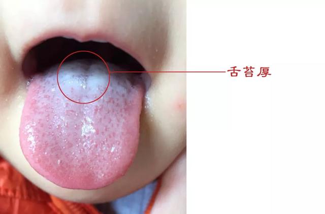 十大细节,来了!对孩子健康心里有底了