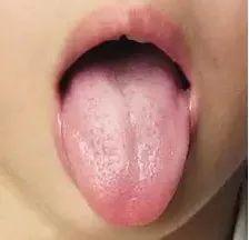 十大细节,来了!对孩子健康心里有底了