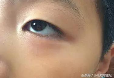 孩子总是无缘无故就生病?5分钟教你精准预判孩子健康状况