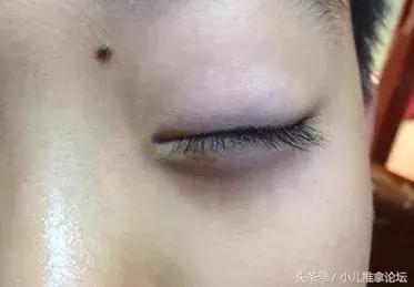 孩子总是无缘无故就生病?5分钟教你精准预判孩子健康状况