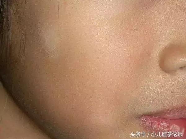孩子总是无缘无故就生病?5分钟教你精准预判孩子健康状况