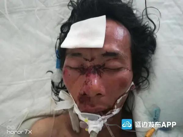 紧急寻人!延边一男子发生交通事故 警方发布寻人启事