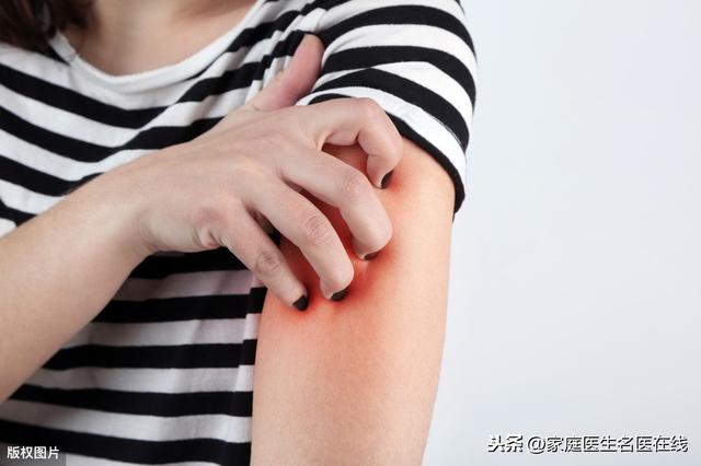 夏天除了防蚊虫,这4类皮肤病也是“榜上有名”,现在知道还不晚