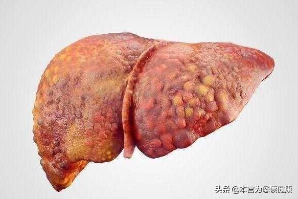 肝好不好,手先知?肝好的人,身上一般没有4异常,愿您全部没有