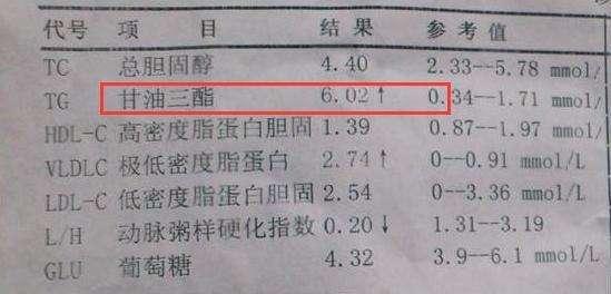 甘油三酯偏高,这3种食物需“忌口”,若你爱吃,血管或加速变堵