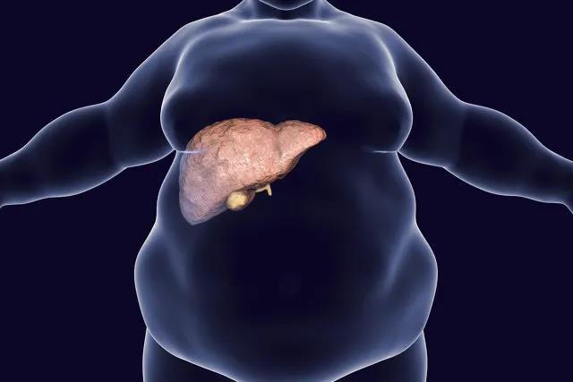 得了脂肪肝，机体免疫力可能大大受损，不能不重视