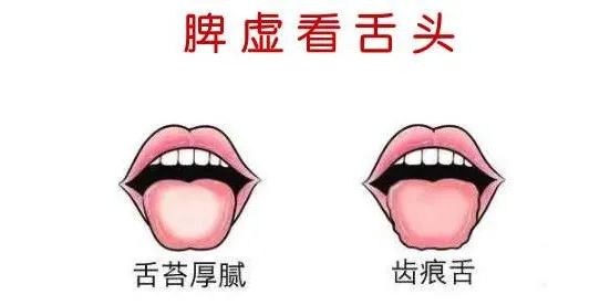 脾胃虚寒,身体状态差,三招帮你防治脾虚腹泻