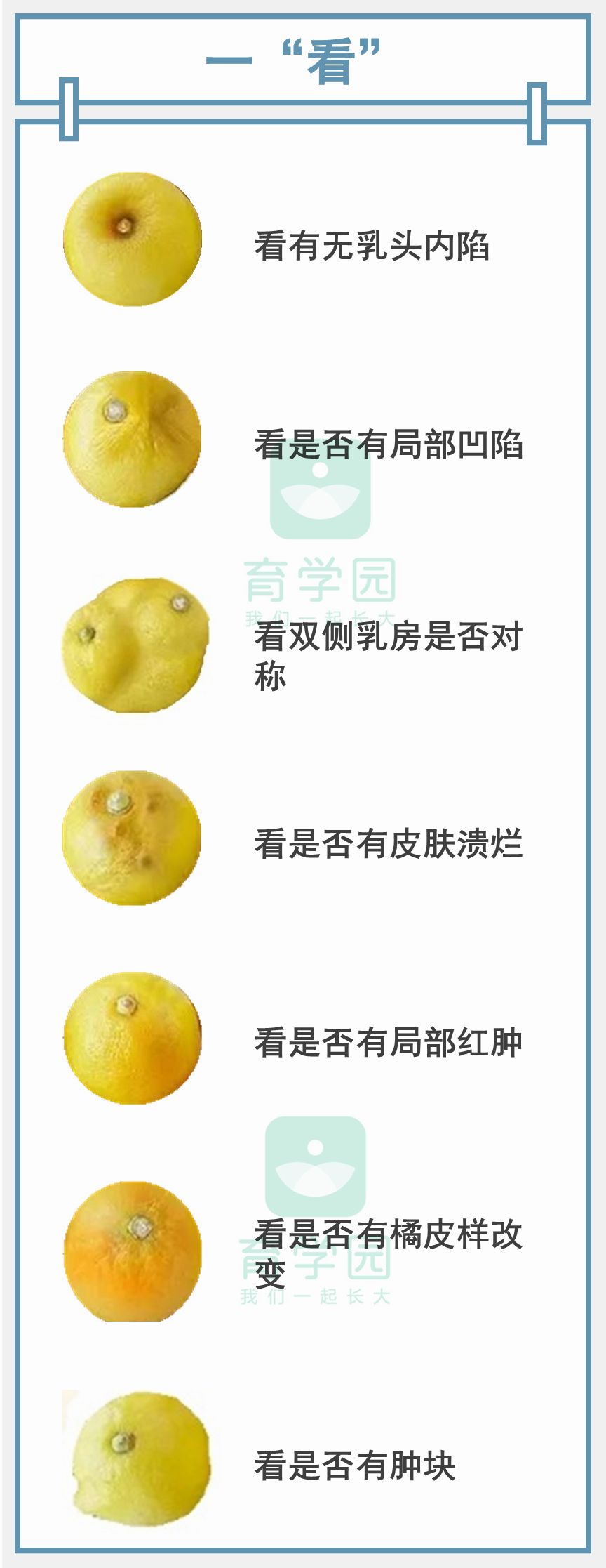 胸大、乳腺增生会得乳腺癌?权威指南:这3类女性才最需要警惕