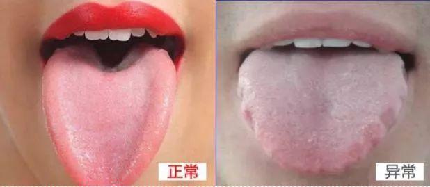 体内湿邪重,3个部位会发出"信号",做好4件事,逼出体内湿气