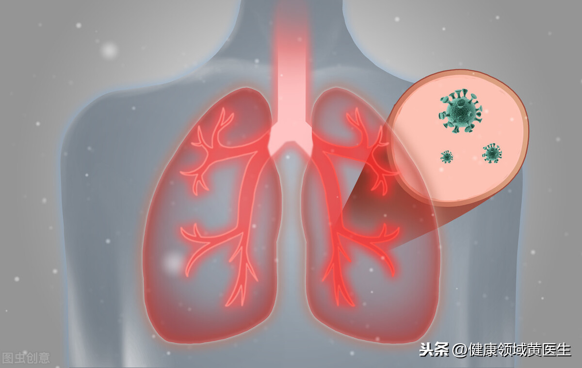 肺炎鉴别以及治疗方法,肺炎要重视起来,保护自己就是保护大家