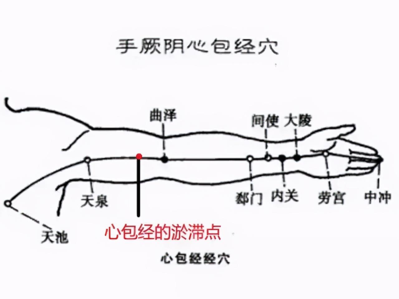心包经——心脏的保护神！很多人不知道的淤滞点，居然有大作用