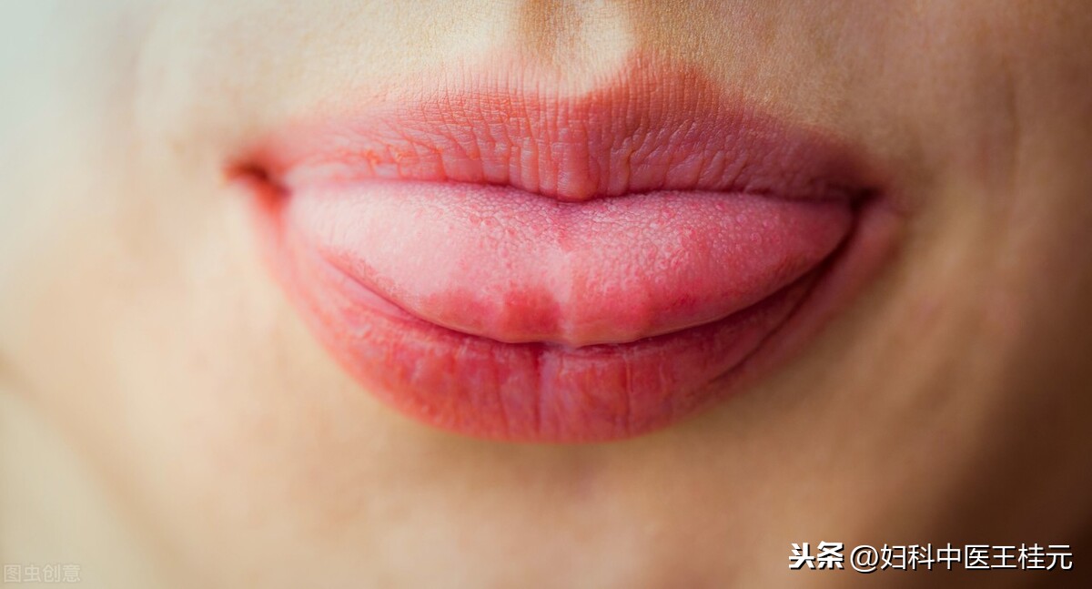 知道自己血瘀该化瘀还是补血?其实活血更重要