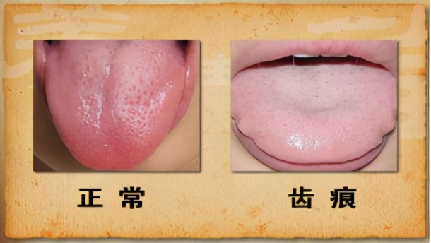 气虚犯懒、血虚脱发，这4个食谱帮你气血充足