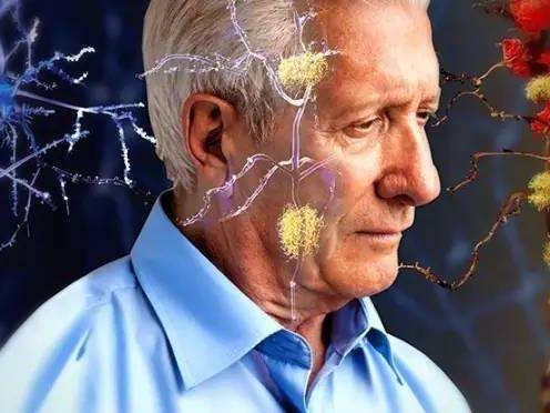 3种食物经常吃,可能会使血管变脆变硬,请你“嘴下留情”
