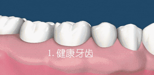 图片3.png