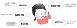 不同部位痘痘和内脏有关?