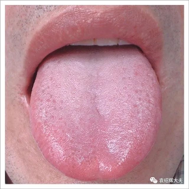 怎样判断哪些食物容易导致我们湿热?