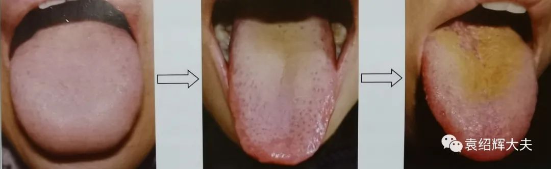 怎样判断哪些食物容易导致我们湿热?