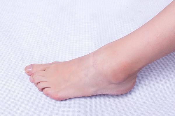睡觉时出现这3种情况,可能是尿酸偏高了,一起来了解一下