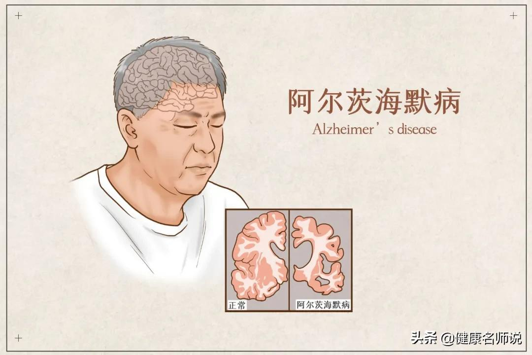 不想被老年痴呆“盯”上,这5个吃饭习惯劝你立刻改掉