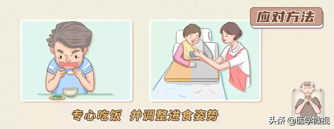 吃饭容易呛?喝水总是咳?警惕这种“隐形杀手”