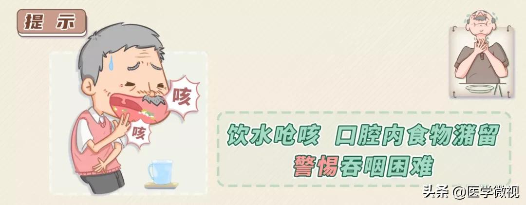 吃饭容易呛?喝水总是咳?警惕这种“隐形杀手”