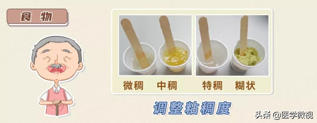 吃饭容易呛?喝水总是咳?警惕这种“隐形杀手”