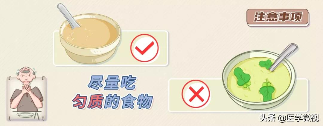 吃饭容易呛?喝水总是咳?警惕这种“隐形杀手”